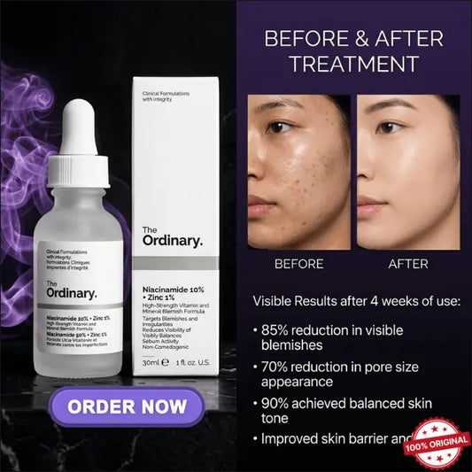 The Ordinary Niacinamide 10%+zinc 1% Serum